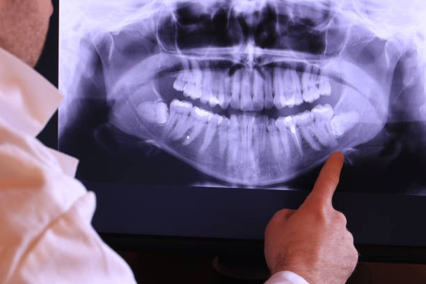 Best Broken or Chipped Tooth Repair in Manor, PA