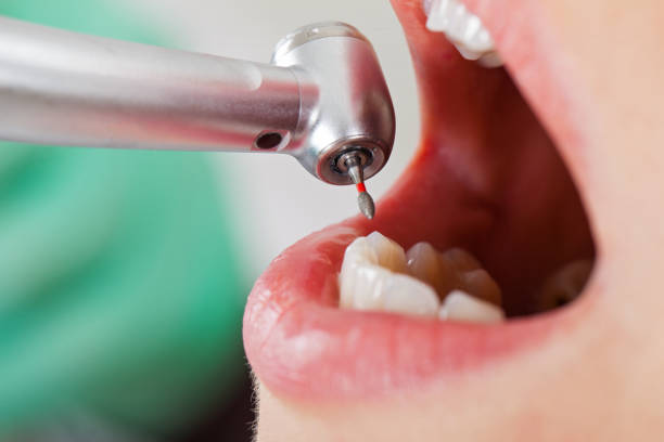 Best Emergency Treatment for Oral Infections in Manor, PA